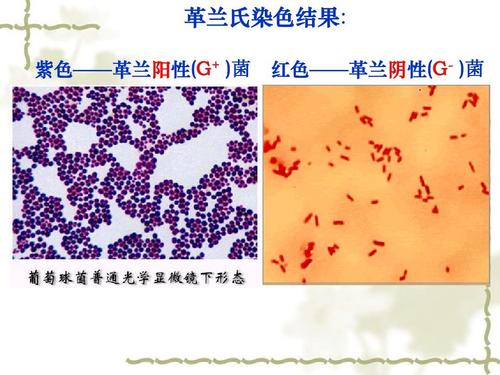 革兰染色原理与方法